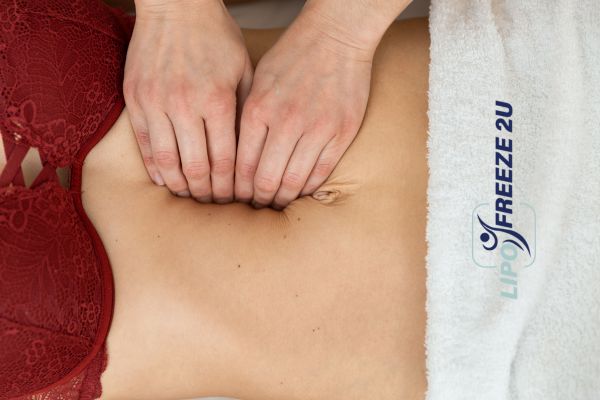 diastasis recti treatment Herne Bay
