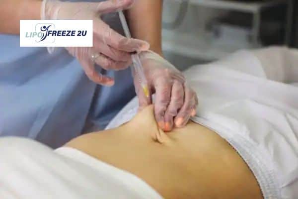 Fat Dissolving Injections Herne Bay & Weight loss medication
