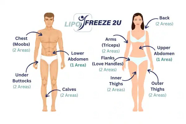 Areas you can have fat freezing treatment Herne Bay